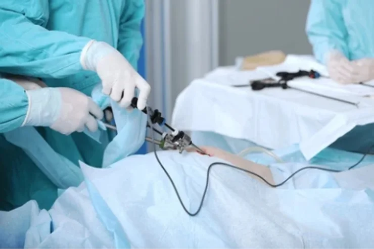 Laparoscopic Surgeries